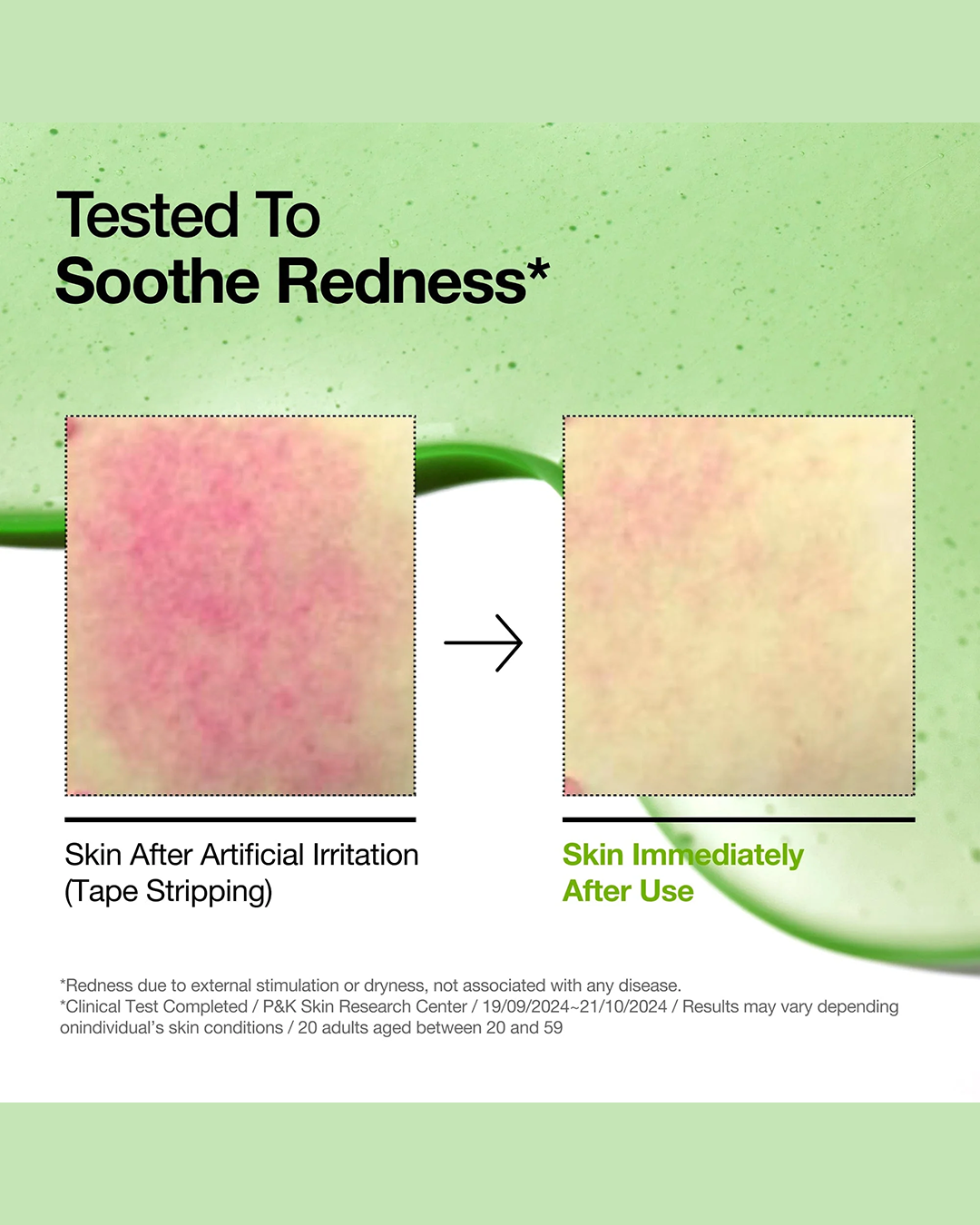 [ANUA] Azelaic Acid 10 Hyaluron Redness Soothing Serum
