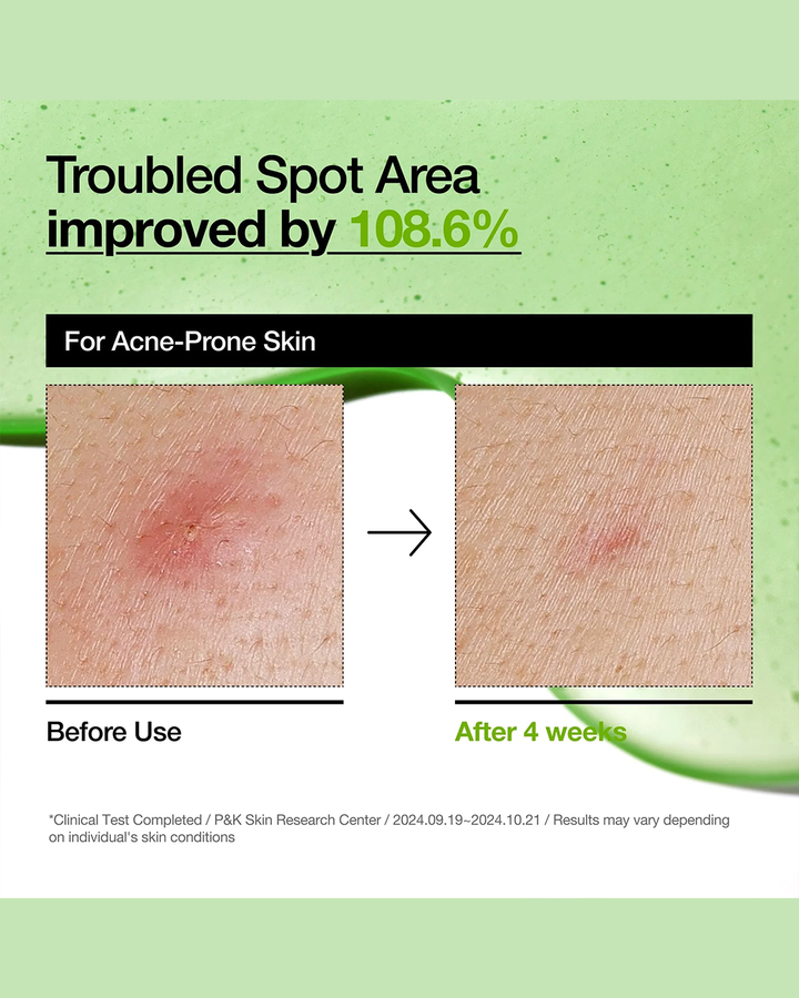 [ANUA] Azelaic Acid 10 Hyaluron Redness Soothing Serum