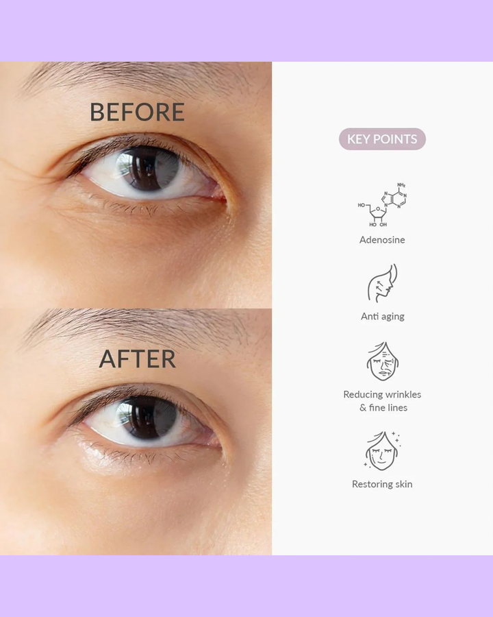 [Dr. Althea] To Be Yothfull Eye Serum