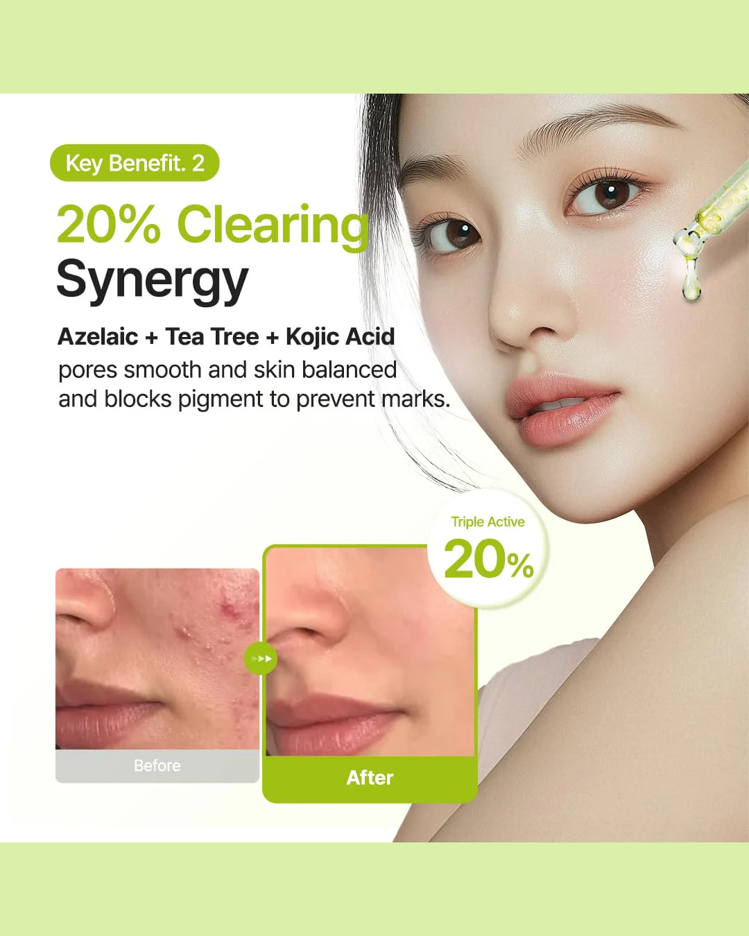 [Purito Seoul] Azelaic Acid 10 Kojic Tea Tree Serum