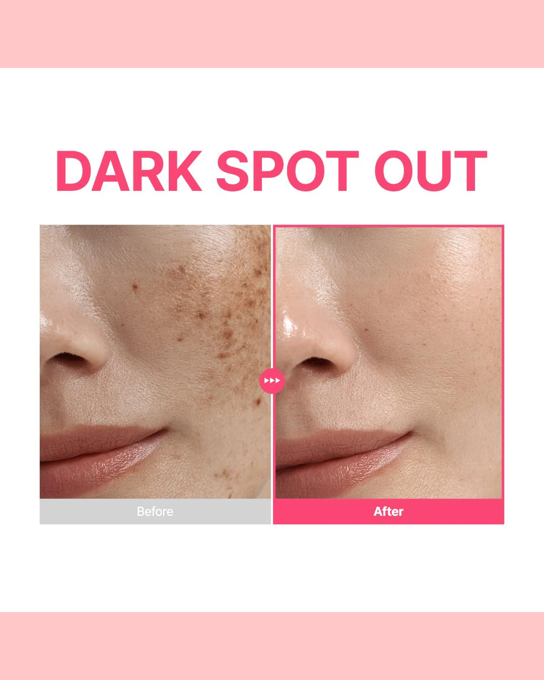 [Purito Seoul] TXA 6 Niacinamide 10 Retinal Serum