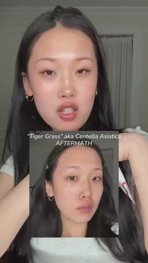 [Centellian24] Madeca Cream Time Reverse (¡Muy Pronto!)